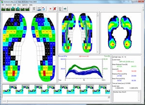 pedar standars step analaysis - force measurement systems | novel.de