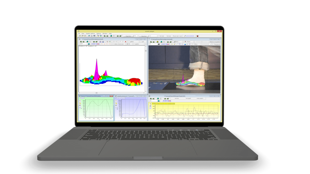 emed - pressure mapping - pressure measurement - gait analysis