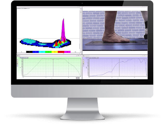 diabetic foot ulcer prevention - diagnosis & treatment | novel.de
