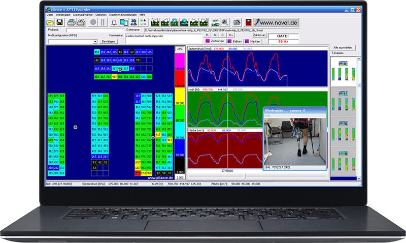 prosthesis pressure measurement - sensing force