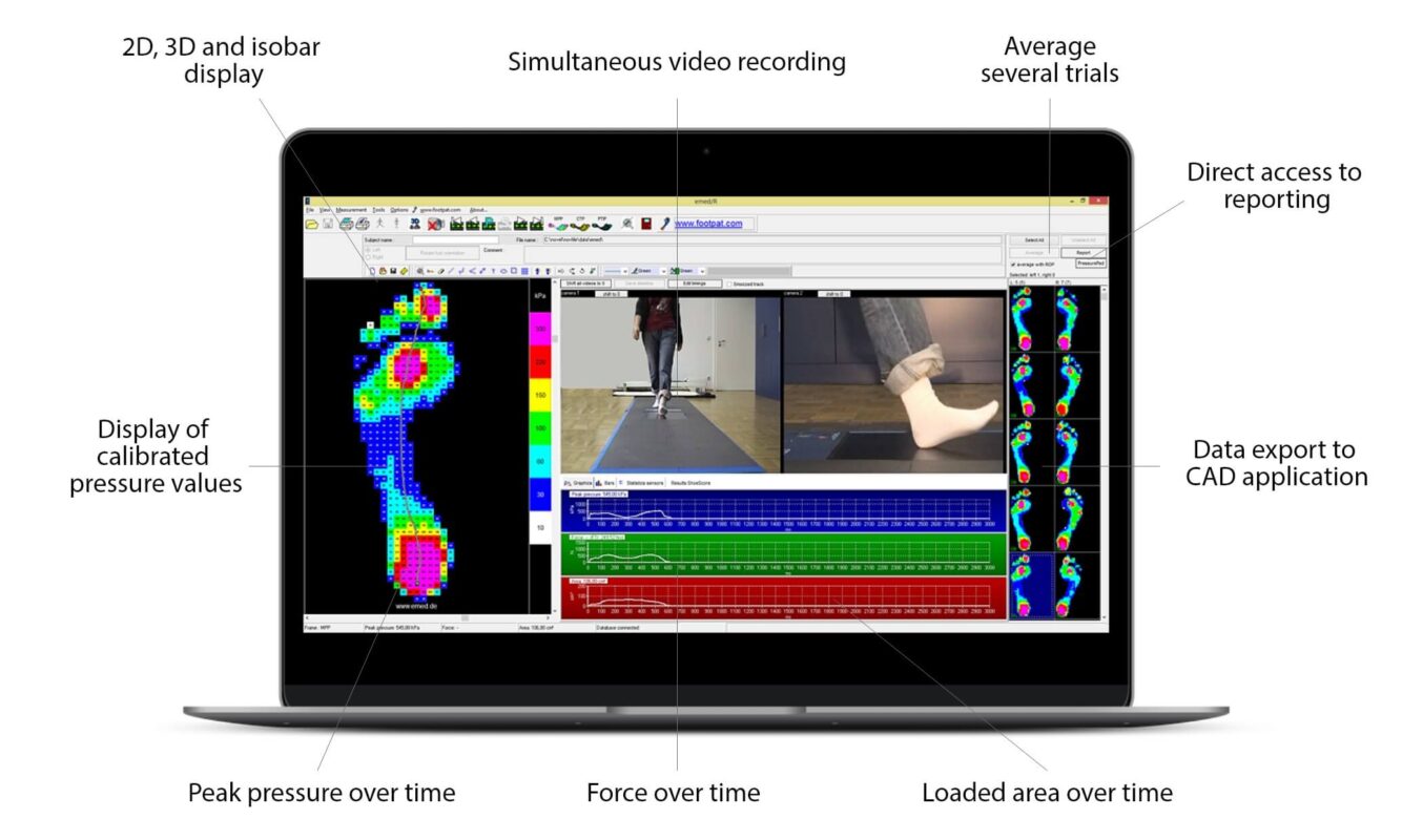 emed - foot pressure mapping platform
